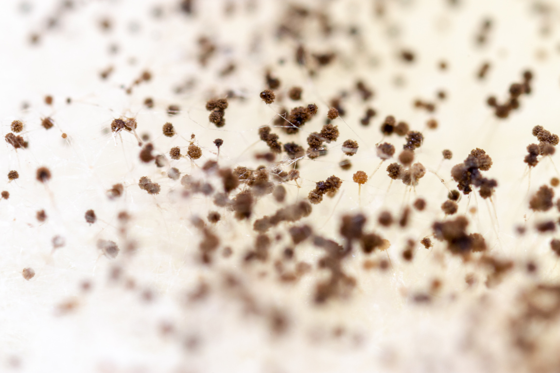 Rhizopus (bread mold) is a genus of common saprophytic fungi,Rhizopus (bread mold) under the microscope.